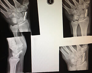 Click image for larger version

Name:	1S6Xf.jpg
Views:	0
Size:	137.0 KB
ID:	74781